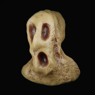 Người đàn ông tan chảy trong nỗi đau khủng khiếp