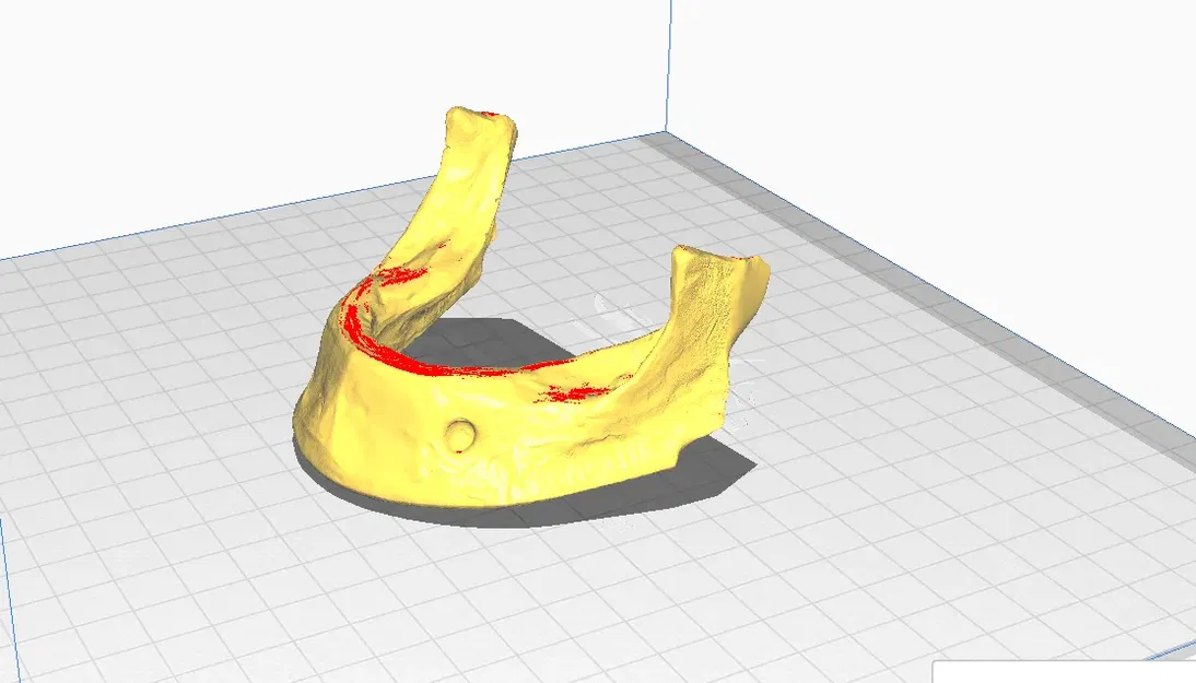 Mô hình hàm dưới không răng in 3D cho giáo dục y khoa - Image 1