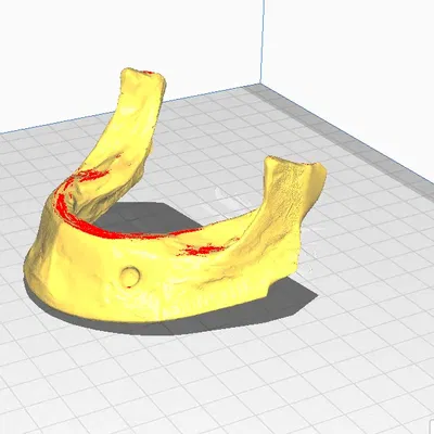 Mô hình hàm dưới không răng in 3D cho giáo dục y khoa