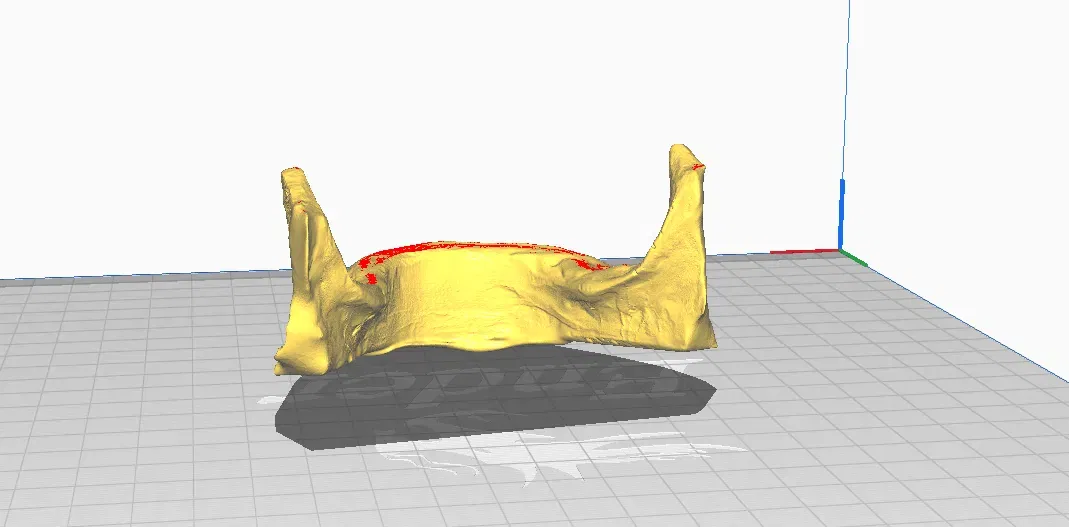 Mô hình hàm dưới không răng in 3D cho giáo dục y khoa - Image 2