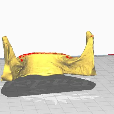 Mô hình hàm dưới không răng in 3D cho giáo dục y khoa