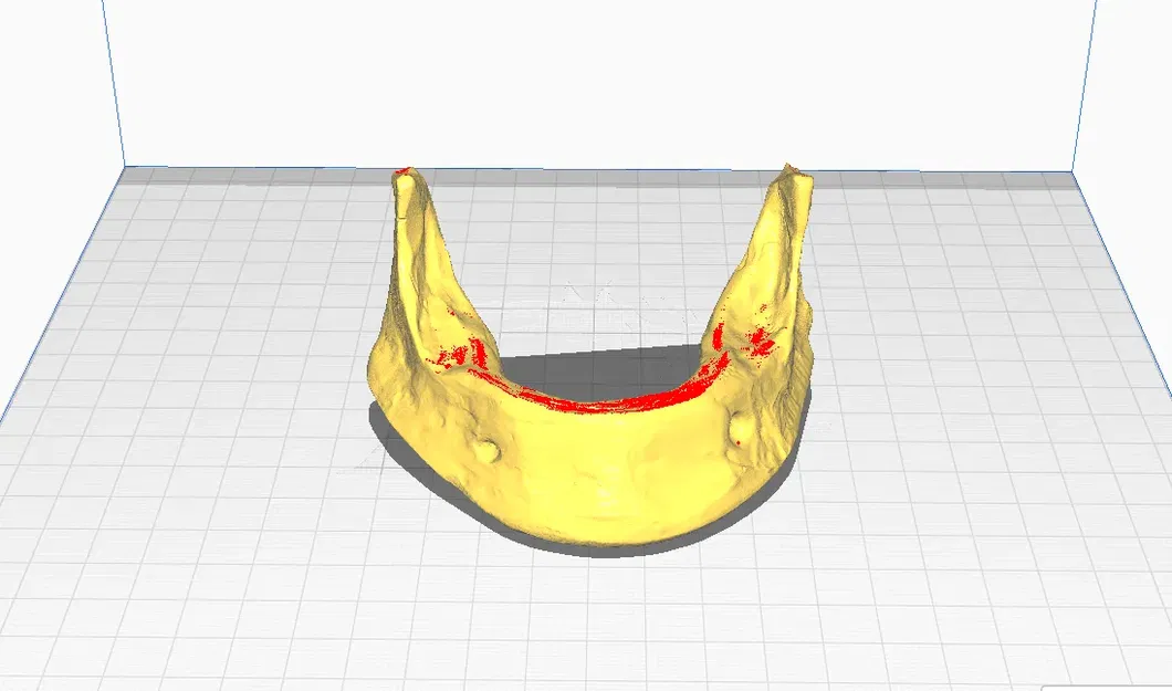 Mô hình hàm dưới không răng in 3D cho giáo dục y khoa - Image 3
