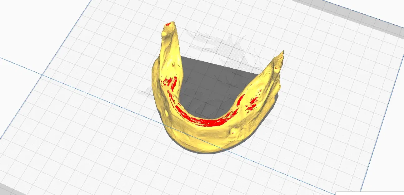 Mô hình hàm dưới không răng in 3D cho giáo dục y khoa - Image 4