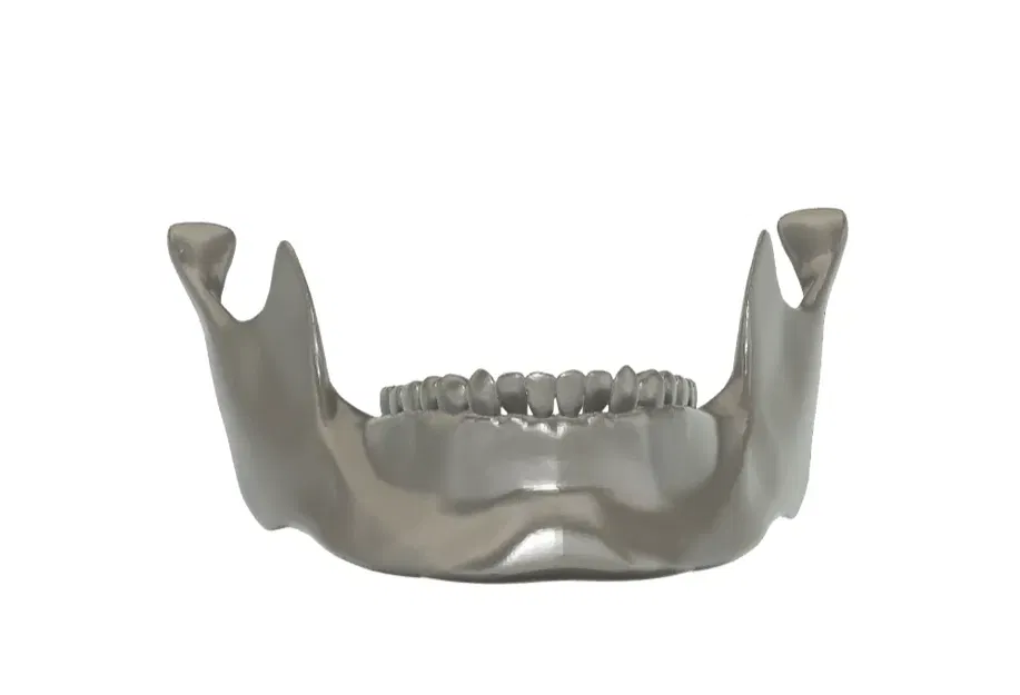 Giải phẫu hàm dưới người - Mô hình in 3D - Image 3