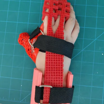 Găng tay phục hồi chức năng cho bệnh nhân đột quỵ