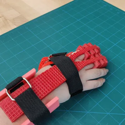 Găng tay phục hồi chức năng cho bệnh nhân đột quỵ