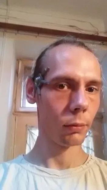 Cấy ghép Borg trong thế giới Star Trek - Image 1