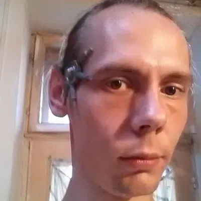 Cấy ghép Borg trong thế giới Star Trek