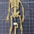 Bộ kích hoạt và giá đỡ cho rối xương - Thumbnail 3