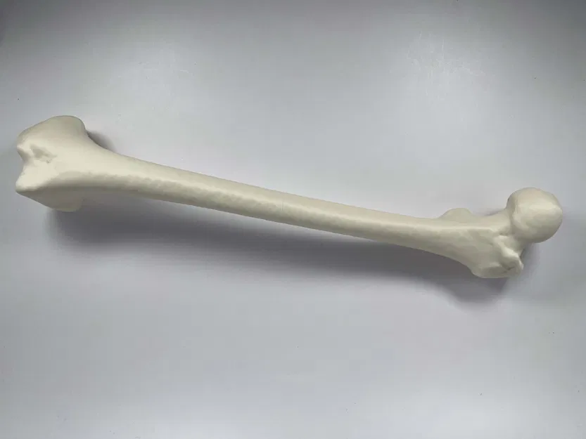 Xương đùi trái của người từ hình chụp CT - Image 1