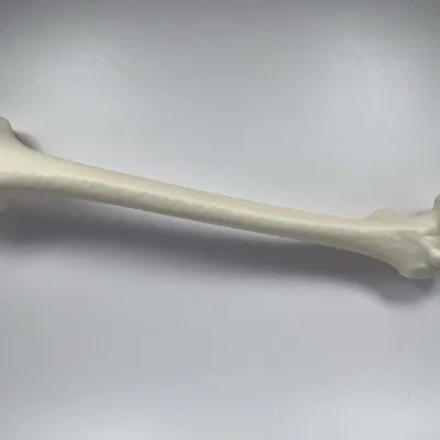 Xương đùi trái của người từ hình chụp CT