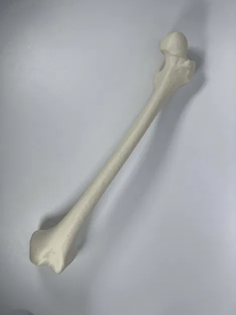 Xương đùi trái của người từ hình chụp CT - Image 2