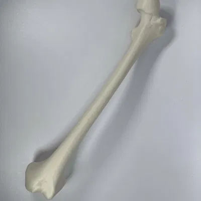 Xương đùi trái của người từ hình chụp CT