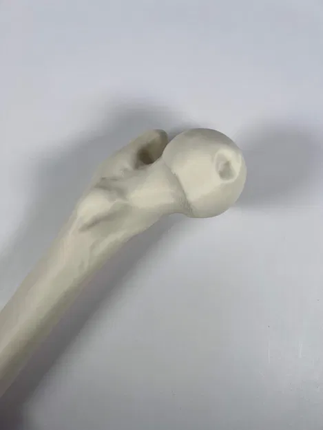 Xương đùi trái của người từ hình chụp CT - Image 3