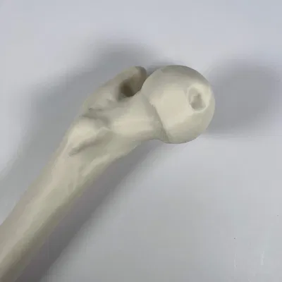 Xương đùi trái của người từ hình chụp CT