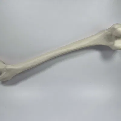 Xương đùi trái của người từ hình chụp CT