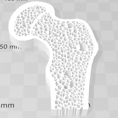 Mặt cắt xương với sự khác biệt giữa xương khỏe và xương...
