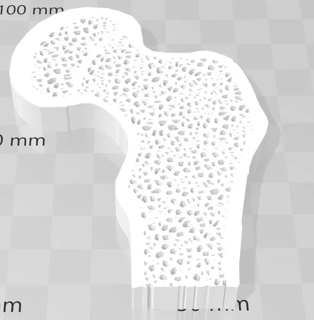 Mặt cắt xương với sự khác biệt giữa xương khỏe và xương... - Image 2