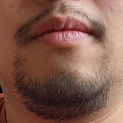 Khuôn tạo râu nhọn tự in cho phong cách cá nhân