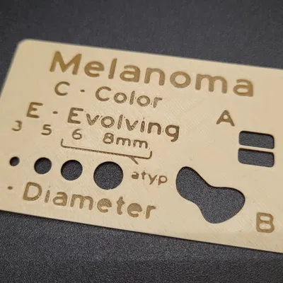 Thẻ Melanoma: Hỗ trợ nhận diện nốt ruồi bất thường