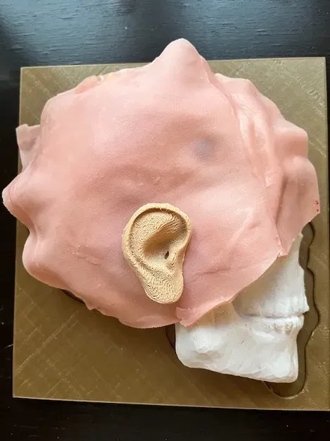 Mô hình y tế mô phỏng quy trình khoan burr - Image 4