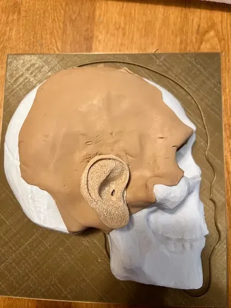 Mô hình y tế mô phỏng quy trình khoan burr - Image 5