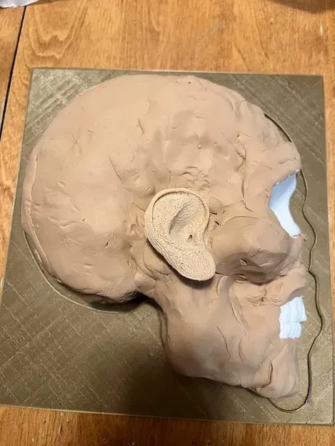 Mô hình y tế mô phỏng quy trình khoan burr - Image 6