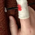 Halloween Nail Accident - Thumbnail 1