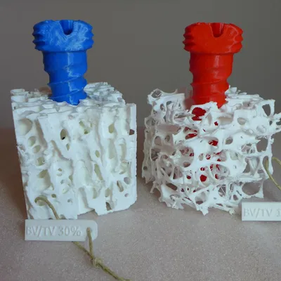 Mô hình xương bè loãng xương kèm vít xương