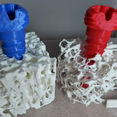 Mô hình xương bè loãng xương kèm vít xương