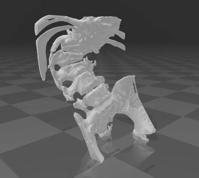 Cột sống (Spine) - Image 1