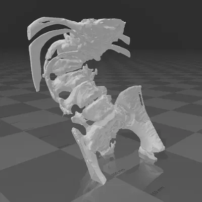 Cột sống (Spine)