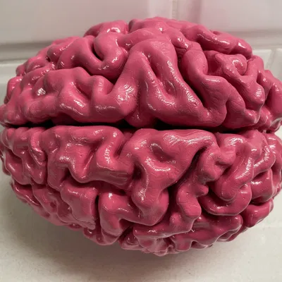Anatomically Correct Human Brain From MRI Scan