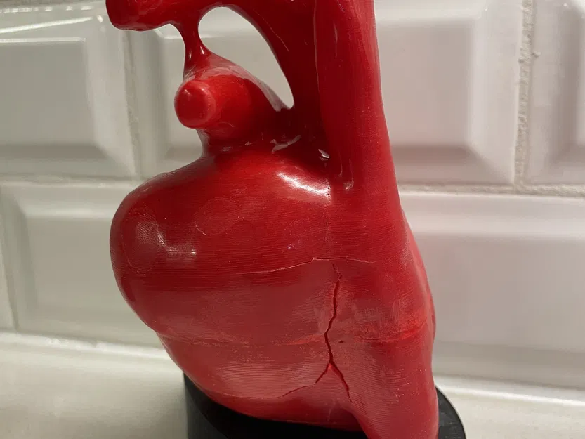 Mô Hình Tim Người Giải Phẫu Từ CT Tim, Kích Thước Thật - Image 2