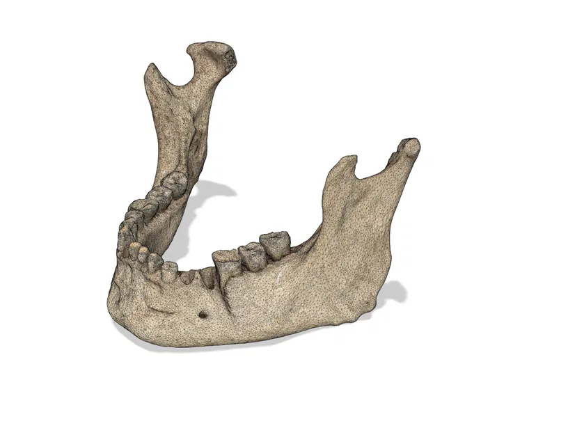 Hộp sọ người với chấn thương chiến tranh (bản quét 3D; Historiska Museet 260727) - Image 6