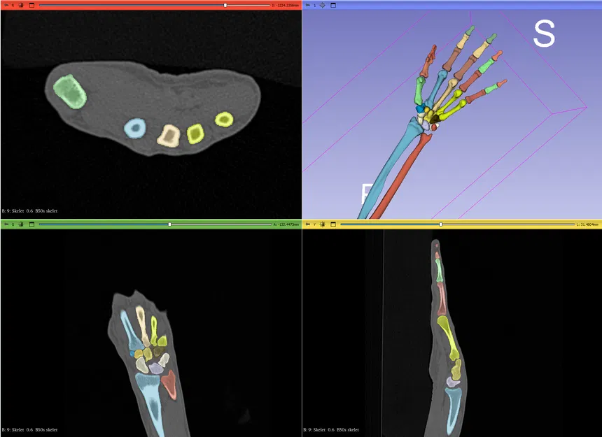 Mô Hình Cánh Tay Dưới Linh Hoạt Kích Thước Thật - Image 4