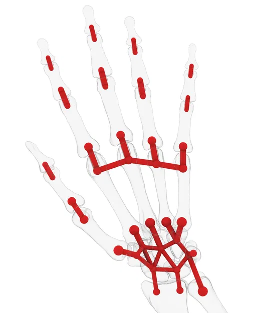 Mô Hình Cánh Tay Dưới Linh Hoạt Kích Thước Thật - Image 8