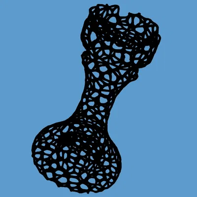 Quân Tốt và Xe Cờ Vua Voronoi, Cờ Vua