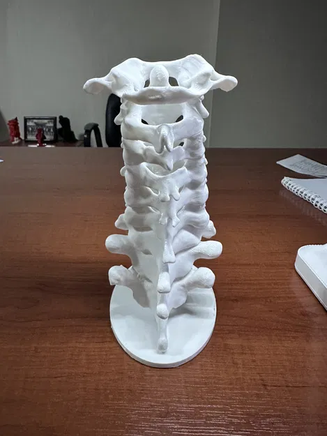 Chân đế đốt sống cổ - Image 3