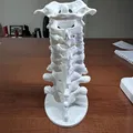 Chân đế đốt sống cổ - Thumbnail 3