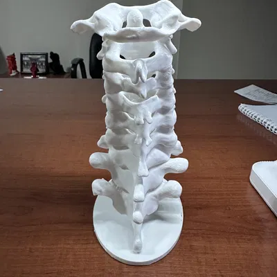 Chân đế đốt sống cổ