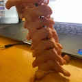 Cột sống cổ (C1 đến C7) - Thumbnail 1