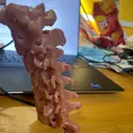 Cột sống cổ (C1 đến C7) - Thumbnail 3