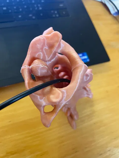 Cột sống cổ (C1 đến C7) - Image 4