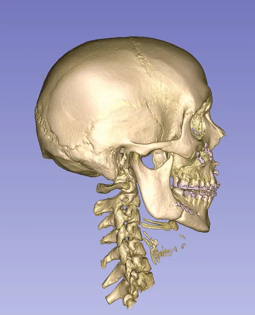 Cột sống cổ (C1 đến C7) - Image 5
