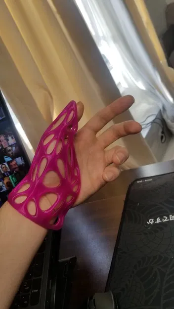 Nẹp Bảo Vệ Ngón Cái Tùy Chỉnh Theo Số Đo - Image 3