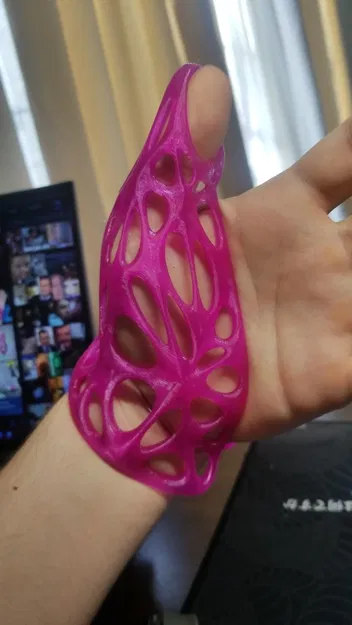 Nẹp Bảo Vệ Ngón Cái Tùy Chỉnh Theo Số Đo - Image 4