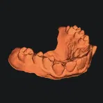 Răng của tui, nếu bạn muốn vì lý do gì đó.