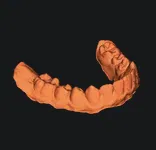 Răng của tui, nếu bạn muốn vì lý do gì đó. - Image 2