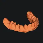 Răng của tui, nếu bạn muốn vì lý do gì đó.